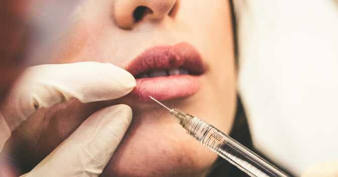 Dermal Fillers