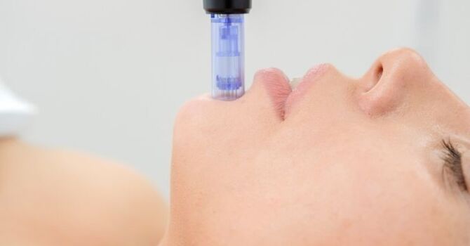 Morpheus8 vs Microneedling: What's the Real Difference?